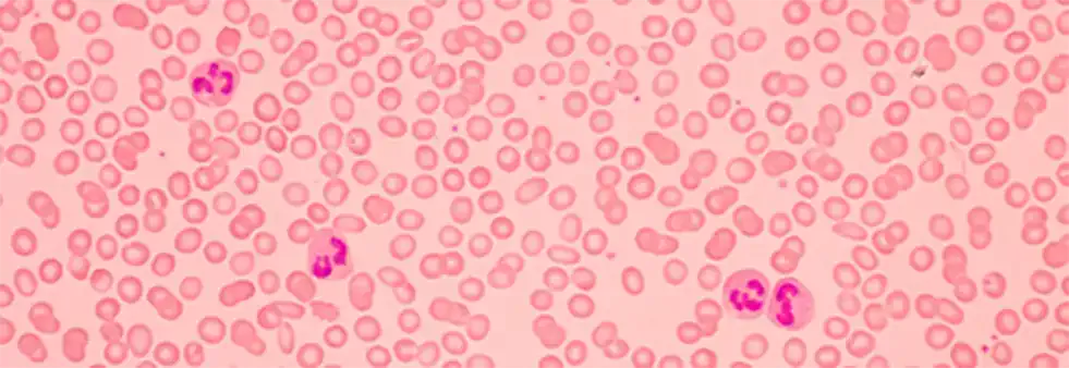 重新定义血型鉴定：i2S Smart Reader 如何以机器视觉颠覆传统免疫血液学